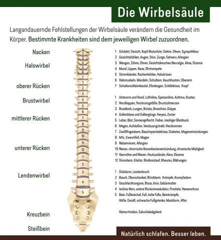 Infografik zur Wirbelsäule und den Folgen dauerhafter Fehlstellungen